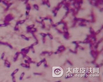 念珠菌病的发病因素有哪些呢