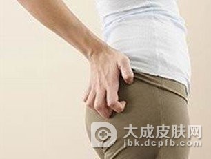 肛门瘙痒症都有哪些症状表现