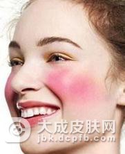 消除脸上红血丝偏方