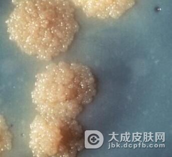治疗一期梅毒应该做好哪些措施