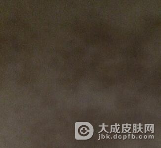 咖啡斑是什么引起的呢