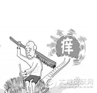 皮肤瘙痒症有哪些治疗要点