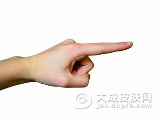 趾断症会有哪些特点