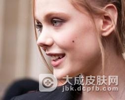 导致色素痣产生的原因有哪些
