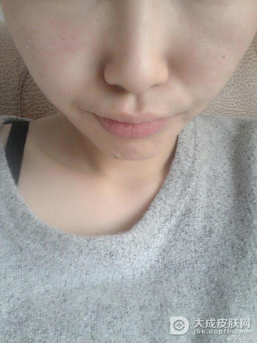 皮肤过敏的主要病因有哪些？