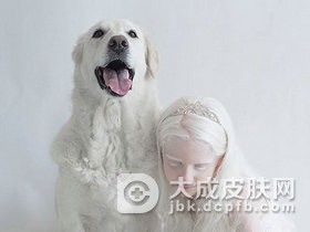 白化病的种类都是哪些呢