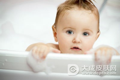 婴儿湿疹怎么办 护理婴儿湿疹不能马虎
