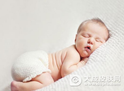 婴儿奶癣湿疹怎么治疗 中医方法安全又有效