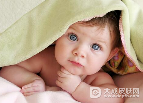 婴儿湿疹怎么回事 婴儿湿疹的相关问题