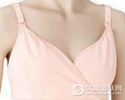 胸部湿疹怎么办 湿疹最佳治疗方法