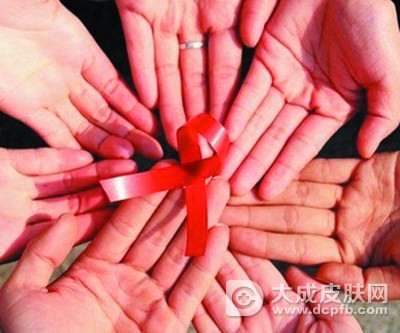 艾滋病能治愈吗