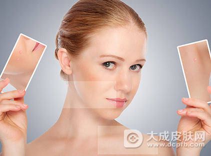 脸上有毛囊炎痘痘怎么办