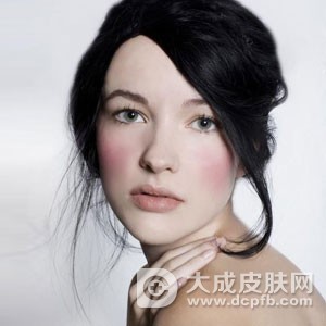 面部皮肤过敏的症状 皮肤过敏的类型