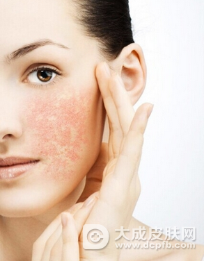 面部皮肤过敏怎么护理