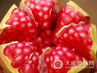 牛皮癣有哪些症状 牛皮癣饮食禁忌大盘点
