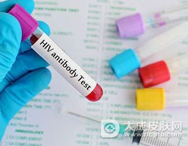 美国研究利用抗体VRC01抑制感染者体内的HIV