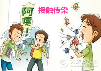秋冬手足口病易发 如何预防手足口病