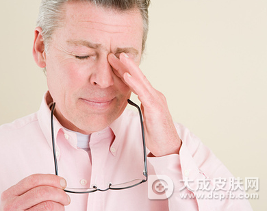 眼睑湿疹是怎么回事 如何预防眼睑湿疹
