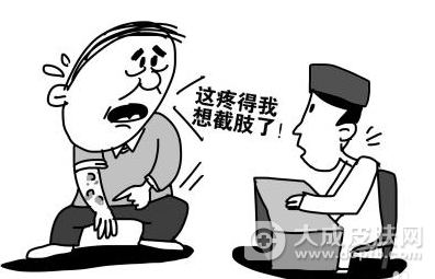 得了带状疱疹怎么办 带状疱疹后遗痛怎么治疗