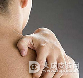 冬季天气干燥皮肤瘙痒多发 可能是皮肤病