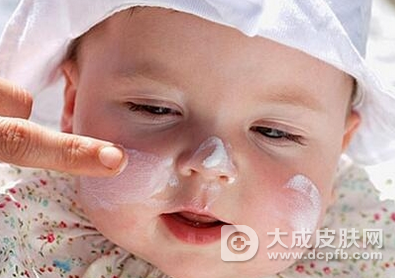 冬季宝宝脸红怎么回事 注意皮肤保湿