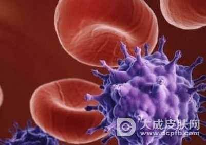 重庆3万余人感染艾滋病 已属艾滋疫情较重地区