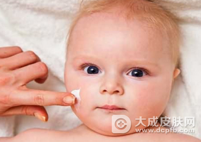 冬季如何预防宝宝皮肤病 常见小儿皮肤病有哪些