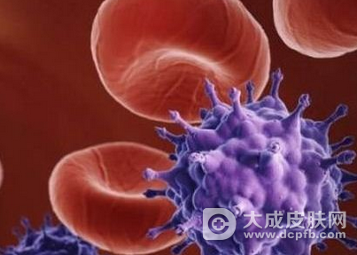 可致感染艾滋病的七大危险因素