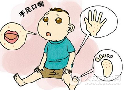 武汉一男婴患手足口病反复感染险丢命