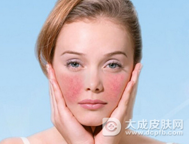 冬季肌肤敏感出现红血丝怎么办