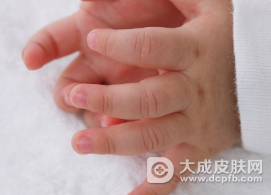 湖南省疾控中心提醒预防手足口病等传染病侵袭