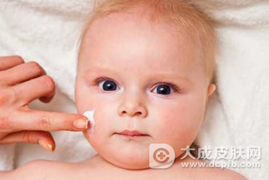 宝宝脸上长湿疹怎么办 湿疹护理小贴士