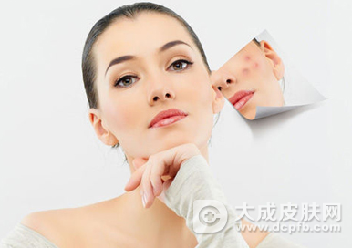 冬天容易长痘痘 少吃这些食物