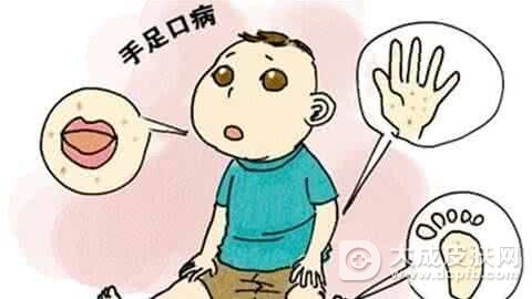 手足口病