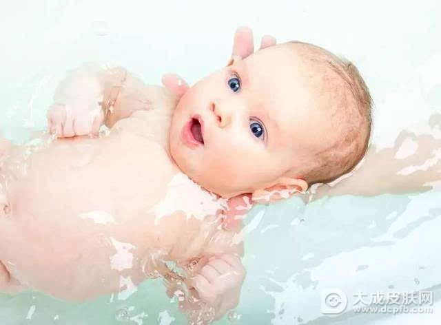 夏季如何预防宝宝长痱子