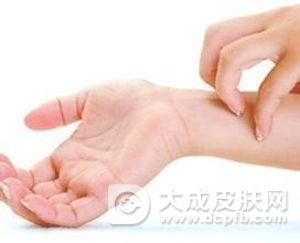 过敏