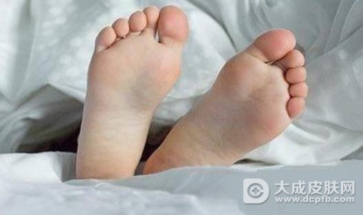 夏季脚臭的原因有哪些 怎么改善脚臭