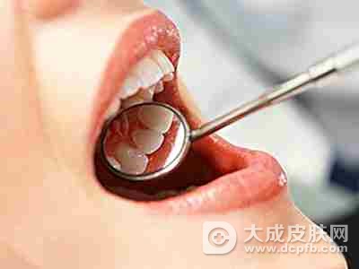 宝宝口腔溃疡 教你偏方改善