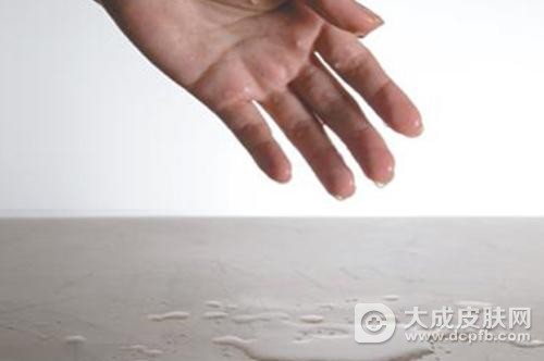 出汗太多小心是多汗症