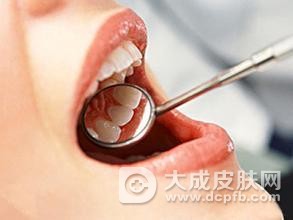 口腔溃疡反复发作,提前预防是关键