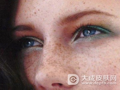 女人脸上出现黄褐斑的原因