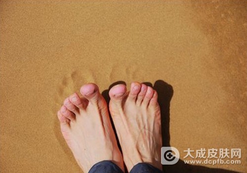 光脚穿鞋加九分裤小心得脚气