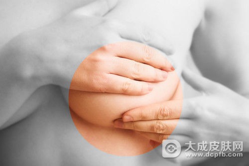 女性乳头瘙痒应当心三种疾病