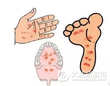 手足