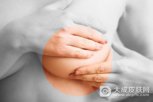 日常乳房瘙痒该怎么护理