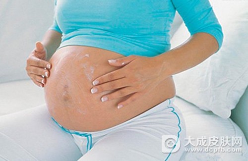 孕后脸上长斑 教你改善小方法