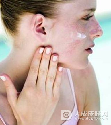 皮肤过敏有哪些症状特点