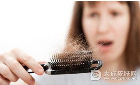 改善经常脱发 做好护理是关键