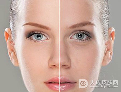 肤色暗沉怎么办 教你改善小妙招