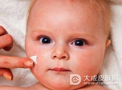 改善婴儿湿疹 日常该怎么护理